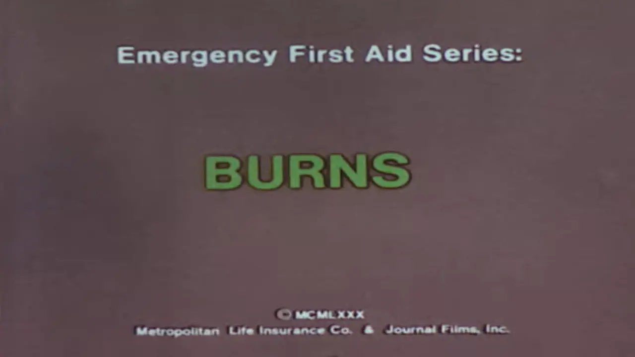 Emergency First Aid Series: Burns backdrop