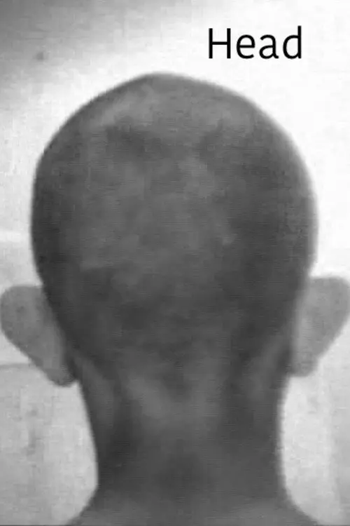 Head